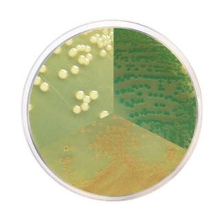 Climate Crisis vs Food Safety: Detection of Vibrio spp